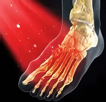 Dispositivo de Terapia Láser Frío Luz Roja Infrarroja Portátil, 650 nm y 808nm, para el Dolor Muscular y Articular